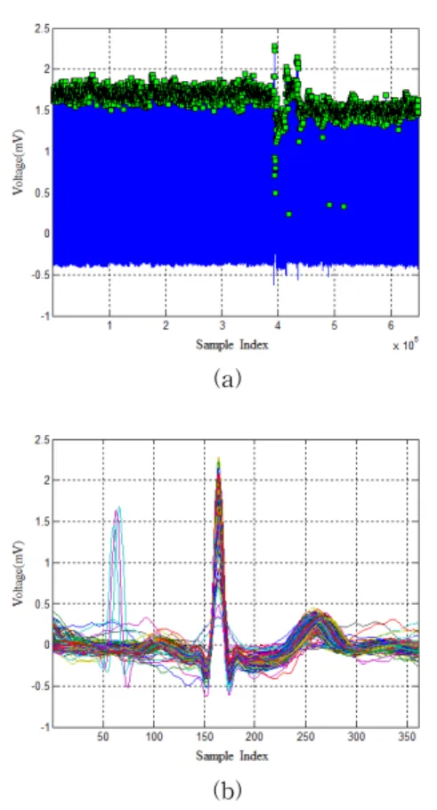 Fig. 10. Cycle division of MIT-BIH arrhythmia database record 103 MLⅡ signal
