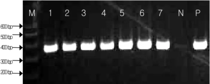 Fig. 1. Results of PCR amplification of the rpoB gene using  mycobacterial reference strains