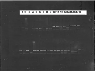 Table 1. General characteristics of the patients groups according to A/C1166 genotype