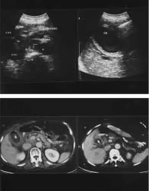 Fig. 1 Preoperative abdominal sonography &amp;