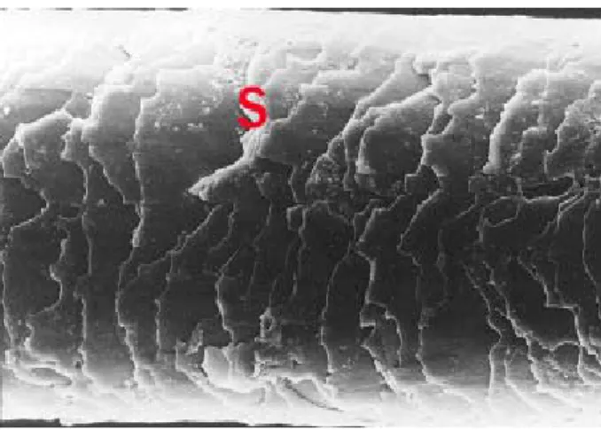 Fig. 2. Scanning electron micrograph of the cross section of a  normal hair shaft showing well organized cuticle(C), fully  developed cortex(Co) and medulla(M)