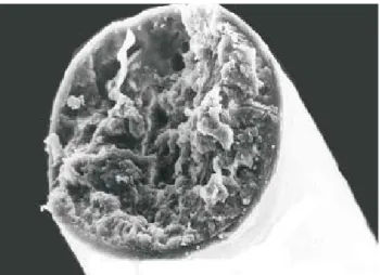 Fig. 4. High magnification scanning electron micrograph of  figure 3. The mummy's hair shaft showing imbricated cuticular  scale  (1,000X).