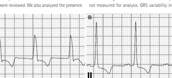 Fig. 1. Representative QRS variability calculation. A: shows initial QRS duration (144 ms) taken on admission day
