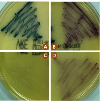 Fig.  3.  Multiple  species  VRE  on  cIDVA.  A;  E.  faecalis ,  B;  E.  faecium , C;  E