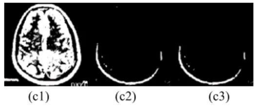 Table 2. Discrete entropy values for the original and processed  images 