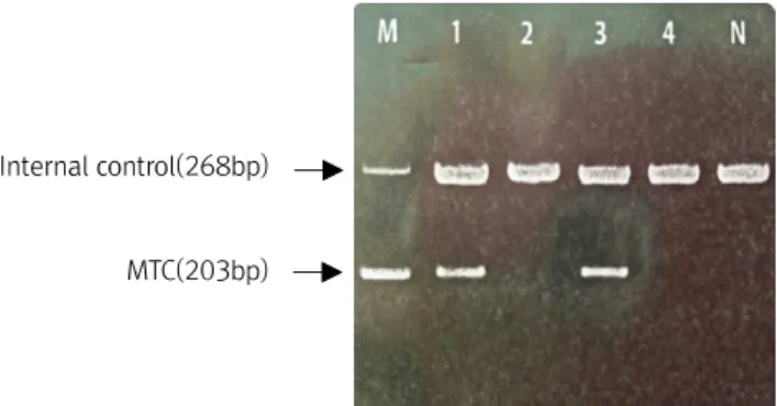 Table  3.  Results  of  amplification  of  DNA  fragment  in  mycobacteria  of  the  tuberculosis  complex  using  pulmonary