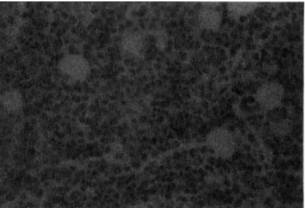 Fig  1.  Hypercellular  BM  of formic  acid  solution  (Deca l.  5hrs.  pH  3.0-4.0 ,  x400) 