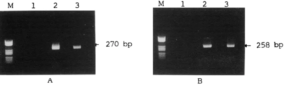 Fig.  1 PCR  amplification  of  hepatitis  B  virus  DNA.  PCR  product  was  electrophoresed  through  2  % 