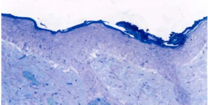 Fig. 1. The control group. Light micrograph of epidermis and  dermis. Toluidine blue stain