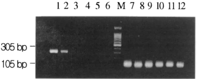 Fig.  3.  RT-PCR  results  of  bcr-abl  rearrangmen t. 