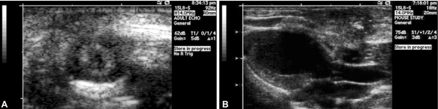 Fig. 1. Echocardiography in parasternal short axis view (A) and parasternal long axis view (B).