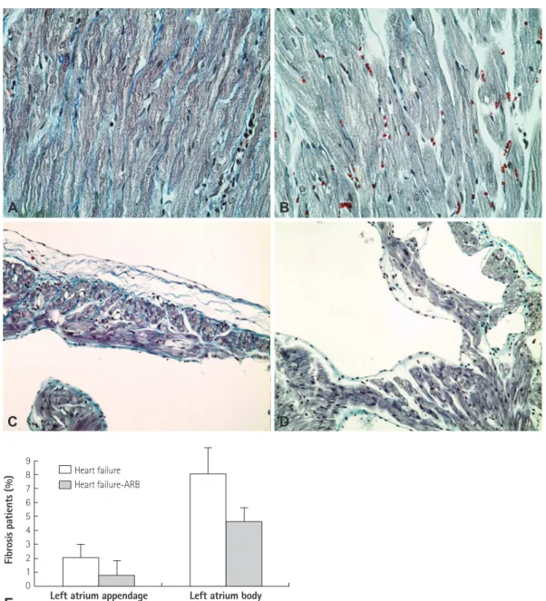 Fig. 5. Representative Masson’s trichrome stain sections of the left atrium from the heart failure group (A and C) and the heart failure-ARB group (B and  D)