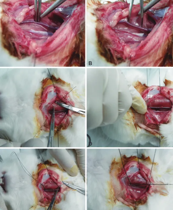 Fig. 2. Mobilization of the carotid artery. The carotid artery was mobilized using blunt dissection is (A and B)