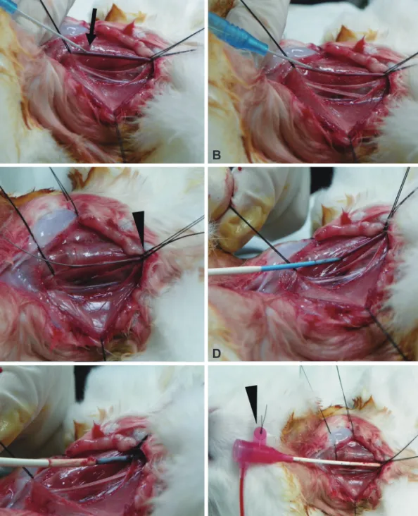 Fig. 3. Puncture technique and insertion of the introducer sheath. The carotid artery was punctured with 22 G angiosheath with the bevel facing down- down-ward (A)