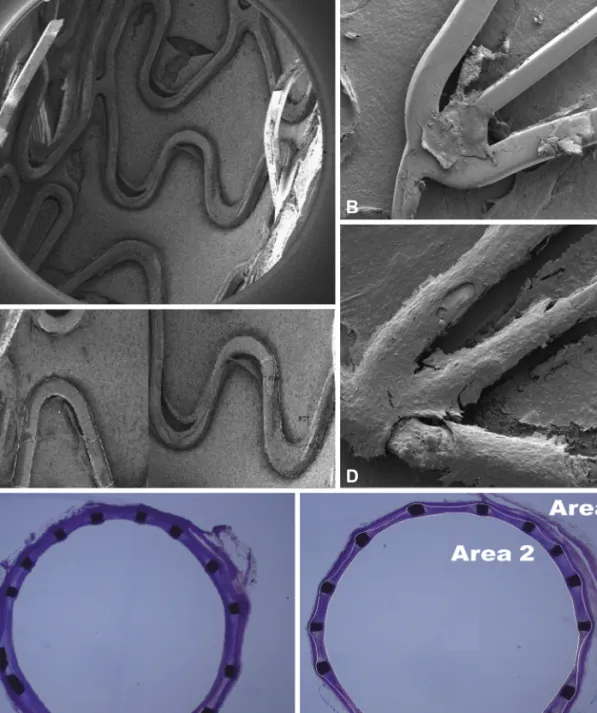 Fig. 5. Assessment of the early re-endothelialization and neointimal area. Scanning the electron microscopic image of a 72-hour harvest sample of anti VE- VE-cadherin antibody coated stents (A)