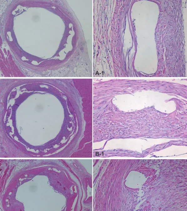 Fig. 1. Representative images of H&amp;E staining after 4 weeks of stenting. Specimen BES implanted (A: ×20, A-1: ×200), ZES implanted (B: ×20, B-1: ×200),  and EES implanted (C: ×20, C-1: ×200)