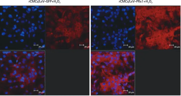 Fig. 6. Immunohistochemistry in rCMCs transfected with LeV-PRx1. PRx1 expression was upregulated in rCMCs/LeV-PRx1 as compared to rCMCs/LeV-GFP  treated with 0.25 mM hydrogen peroxide for 2 hours