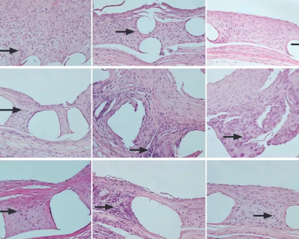 Table 4. Endothelial function assessed with the acetylcholine provocation test at 3 months after stenting