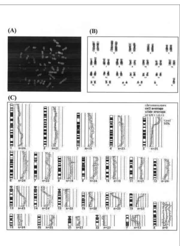 Fig. 1 A typical example of comparative genomic hybridization analysis(case No.11).