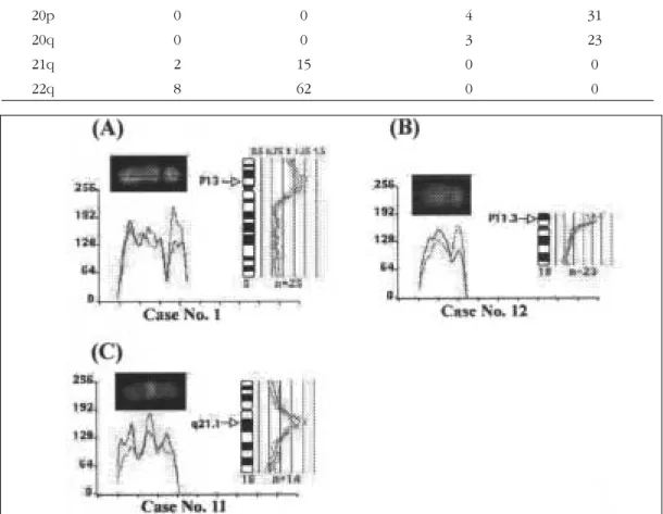 Fig. 3 Partial karyotypes and CGH profiles showing three cases of regional amplifications, (A) 5p13 in case No
