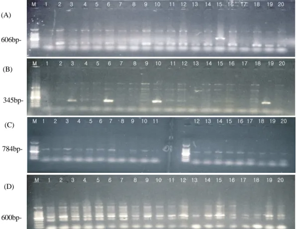 Fig. 1. PCR-SSP patterns of HLA-B. 