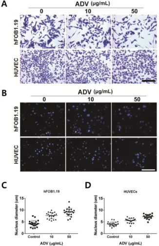 Figure  1.  Evaluation  of  morphological  changes  of  HUVECs  and  hFOB1.19  cells  after  ADV  treatment