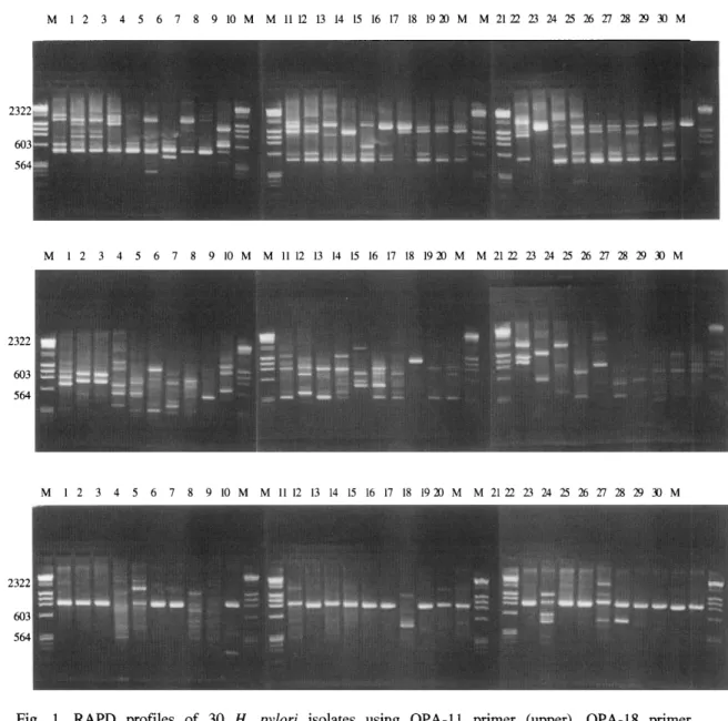 Fig.  1.  RAPD  profiles  of  30  H.  pylori  is이ates  using  OPA-ll  primer  (upper) ,  OPA-18  primer  (middle)  and  OPA-19  primer  (bottom)