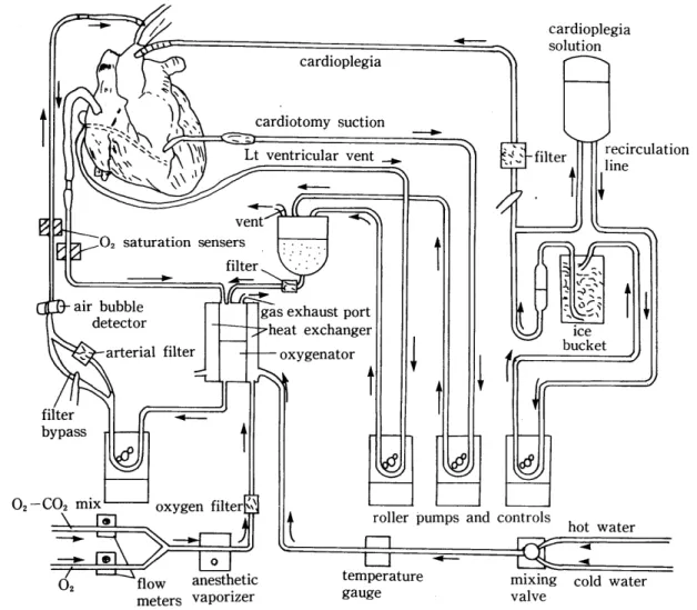 그림  1.  Schematic  diagram  of cardio - pulmonary bypass 