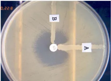 Fig. 1. Modified Hodge test. A, imipenem-hydrolysing strain  which distorted the inhibition zone; B, imipenem non-  hydrolysing strain with no effect on the zone.