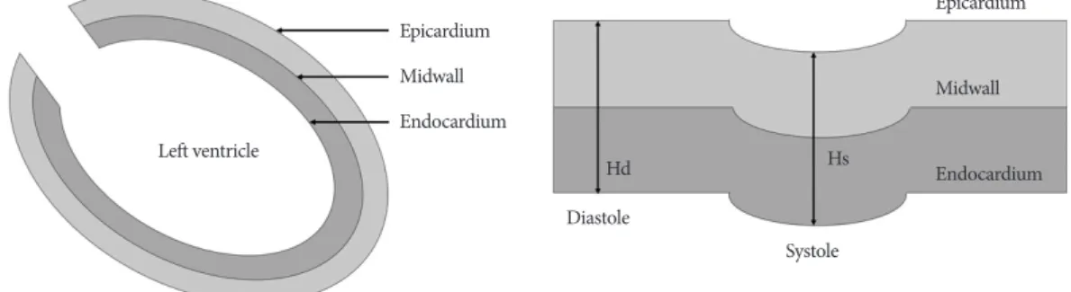 Fig. 1. Schematic representation of two shell geometry model of midwall. Hd: diastolic thickness of shell, Hs: systolic thickness of shell.