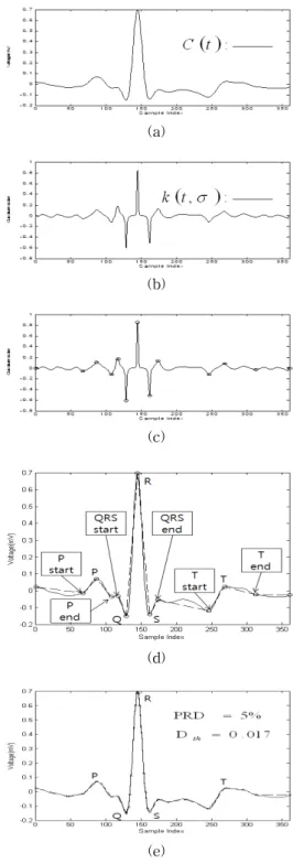 Fig.  7.  Performance  comparison  of  AZTEC  algorithm  and  the  proposed  algorithm  on  Record  100(MLⅡ) 