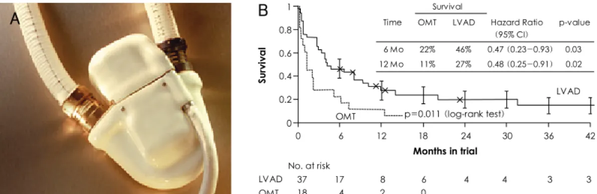 Fig. 8. The NovaCor electrical implanted LVAD was designed, from the outset, as a permanent solution to end-stage heart disease