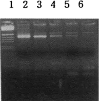 Figure  4.  Agarose  gel  electrophoresis  of  competi- competi-tive  PCR  products. 