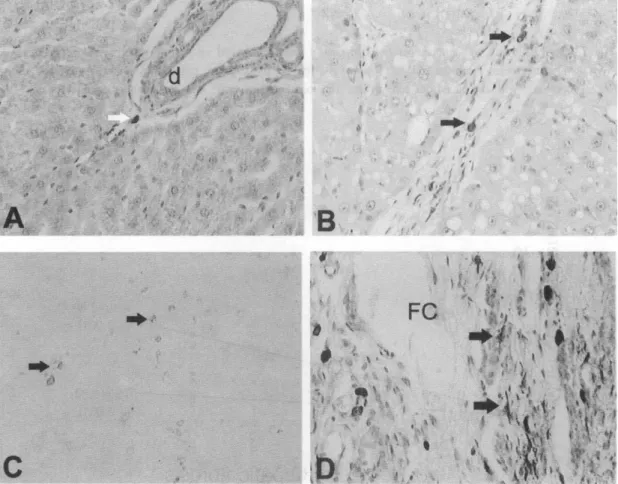 Fig.  6.  (A)  Distribution  and  density  of mast  cell  in  control  and  CC1 4 -treated  rat