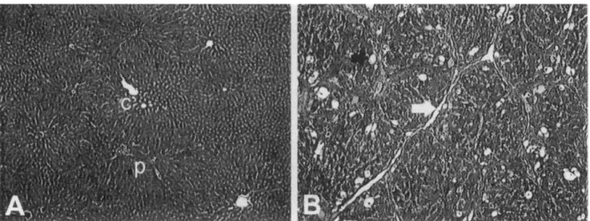Fig.  1.  Light  TIÚcrographs  of  control  and  CCL-treated  liver.  Control  r.따(A)  shows  nonnal  structure  without  fibrous  septa