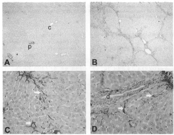 Fig.  4.  Q-smooth  muscle  actin(Q-SMA)  staining  in  control  and  CC4-treated  ra t