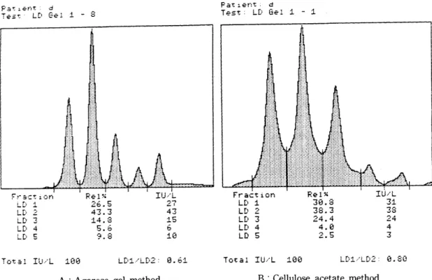 Fig.  1  .Comparison  of  LDH  isoenzyme  densitogram  between  cellulose  acetate  and  agarose  gel  method 