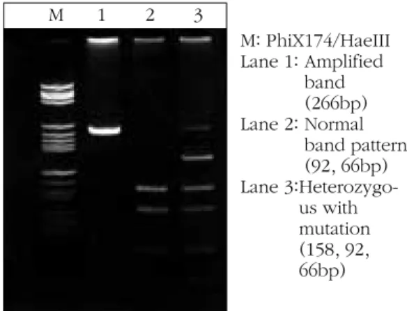 Fig 2. Direct sequencing analysis of p53 exon 7 using ABI 310 genetic anayzer. AGG(Arg) to AGTSer):