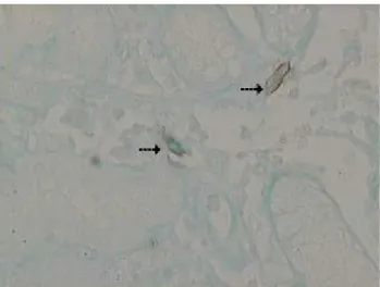 Fig. 2. A microscopic picture of the mucosa with H. 