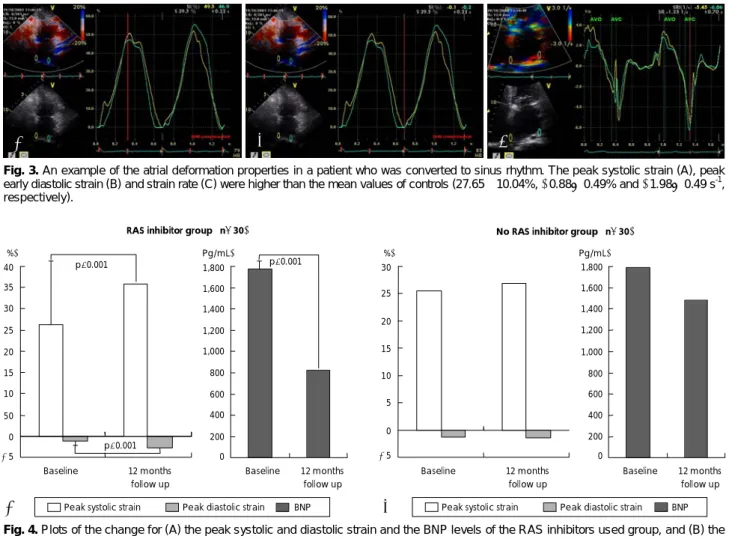 Fig. 3. An example of the atrial deformation properties in a patient who was converted to sinus rhythm