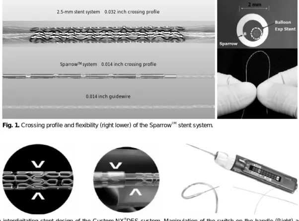 Fig. 1. Crossing profile and flexibility (right lower) of the Sparrow TM stent system.