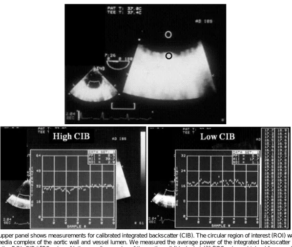 Fig. 3. The upper panel shows measurements for calibrated integrated backscatter (CIB)
