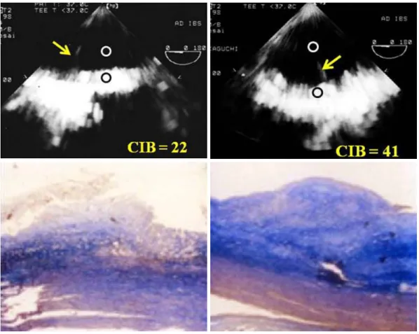 Fig. 4. Pathological examination. In a trunk filled with a saline solution, the aorta in which TEE examinations were performed to measure calibrated integrated backscatter (CIB) were delimited by a metallic pin (pins are shown in the upper panels)