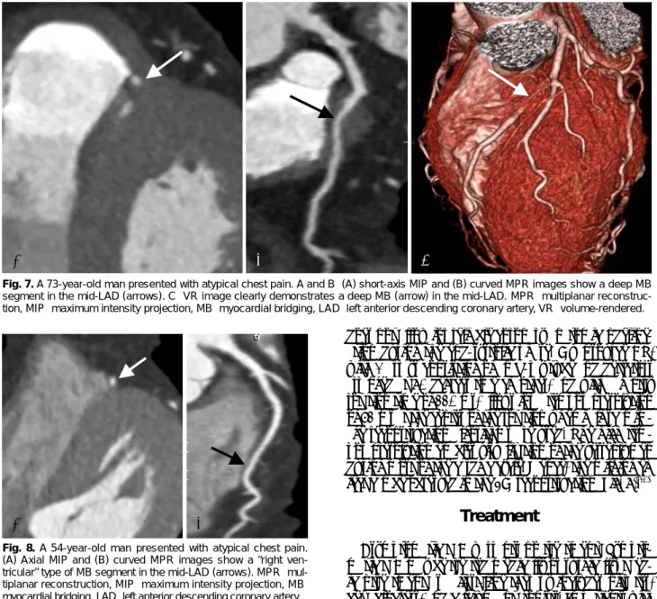 Fig. 8. A 54-year-old man presented with atypical chest pain.