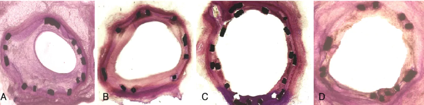 Table 2.  Histopathologic assessment of porcine coronary arteries at 4 weeks after stenting