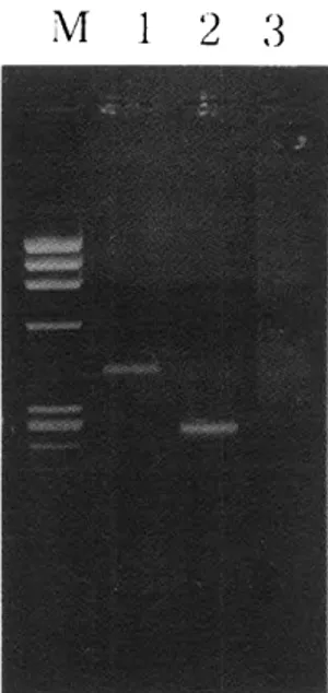 Fig.  2.  Amplified  DNA  products  of  first  PCR  and  second  PCR  in  rpo  β  region  of  M  tuberculosis