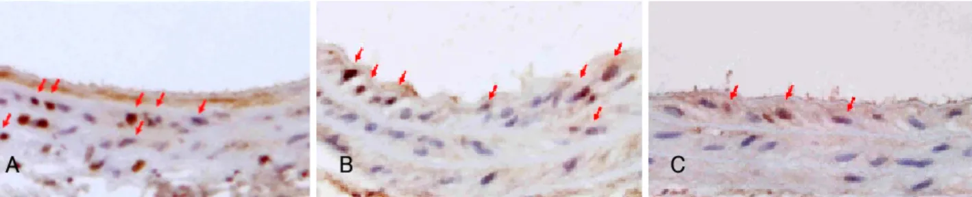 Fig. 2.  The mitotic index (assessed by in situ BrdU labeling) 2 days after the infliction of a balloon injury was significantly reduced in the 11 week old group (n=4, 9.22±1.51%) compared to the 6 week (n=4, 25.03±3.92%) and 8 week old (n=4, 21.66±3.66%) 