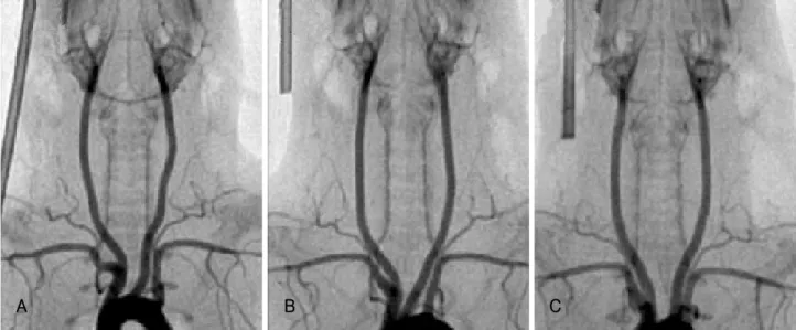 Fig. 3.  Representative carotid angiograms of 6, 8 and 11 week old rats. The mean luminal diameter (MLD) of the right carotid artery was measured by comparison with a 5F coronary catheter
