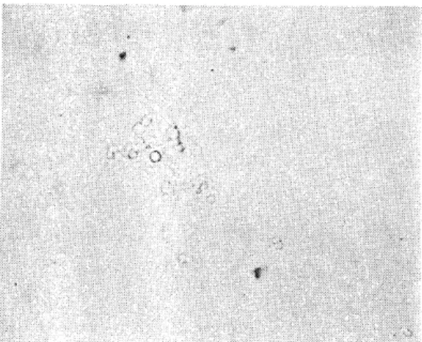 Fig.  1.  Candida  albicans  with  devielopng  germ  tube.(X400) 