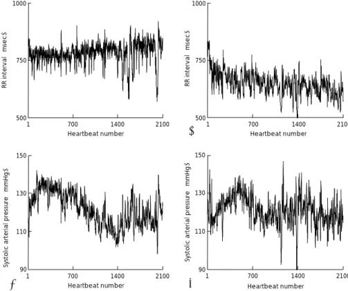Fig. 1.  A and B are two RRI sequences recorded in supine position and head-up tilt position